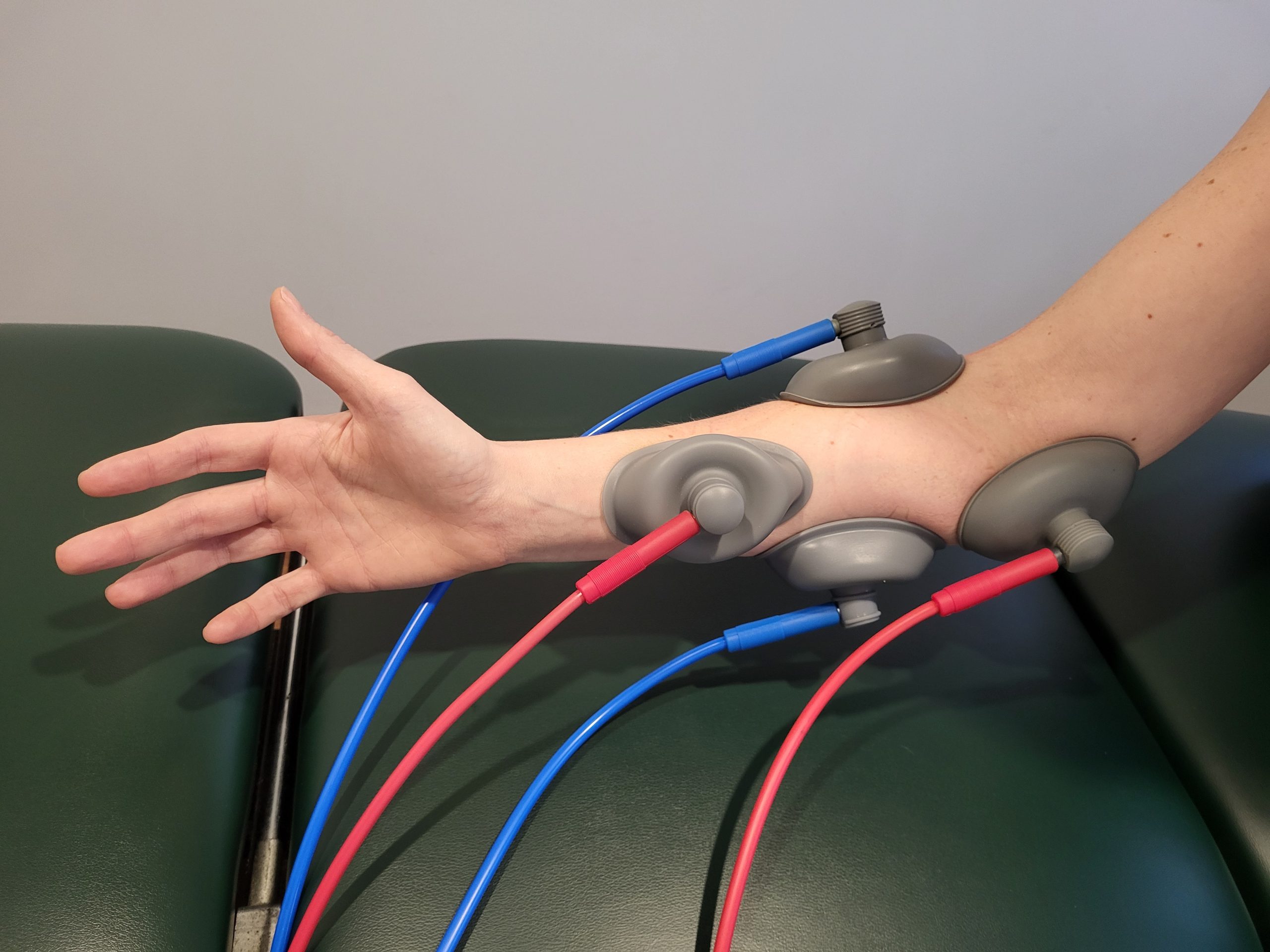 A shockwave treatment being performed on patient's arm