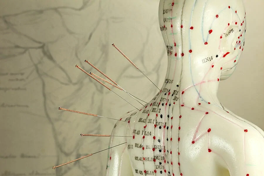 Acupuncture points shown on dummy